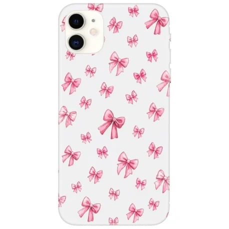 TeknobaStore_09094851c361e6cf4d72125df2aacbd2 Pink Bows - Görsel 1